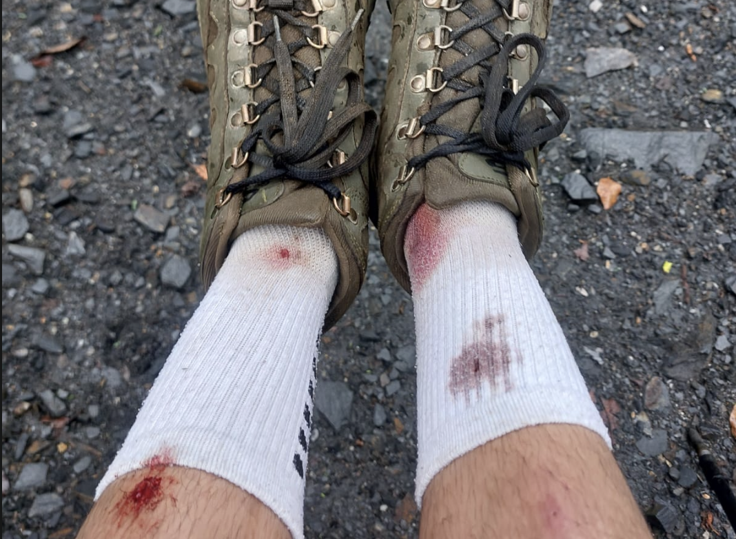 Bloodied socks from leech attacks